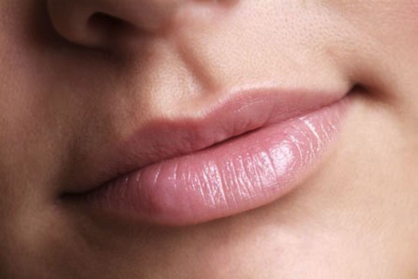 lip refresh: new hyaluronic acid for lips